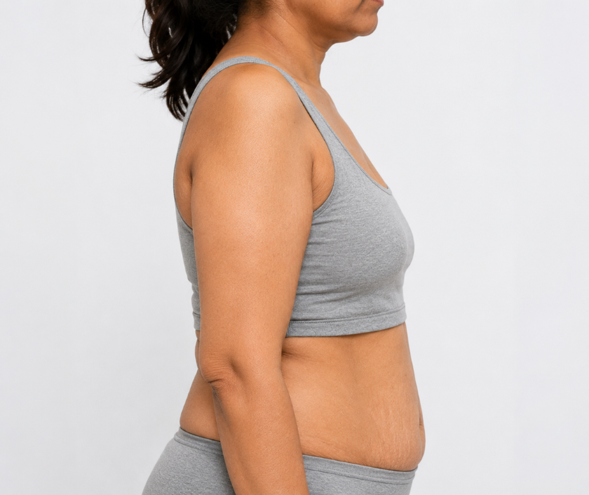 Deflated & Sagging Breasts in Surat at Elegance Clinic