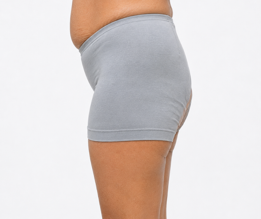 Flat & Sagging Buttocks in Surat at Elegance Clinic