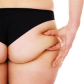 Sagging Buttocks