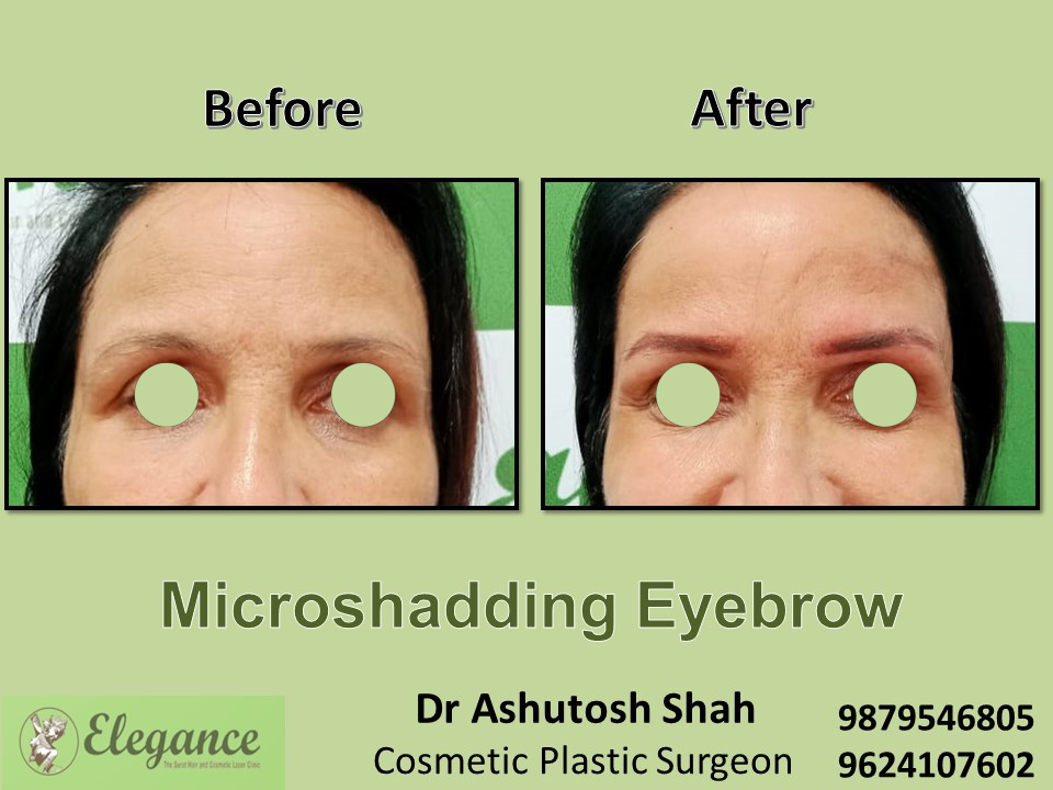 Permanent Makeup before and after results at Elegance Clinic Surat