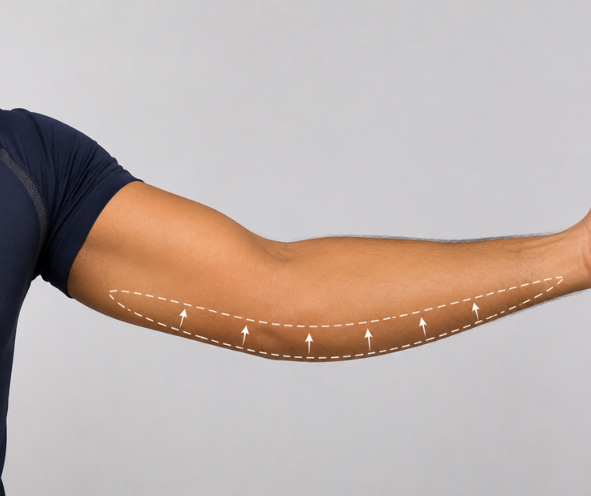 Forearm Tightening in Surat at Elegance Clinic