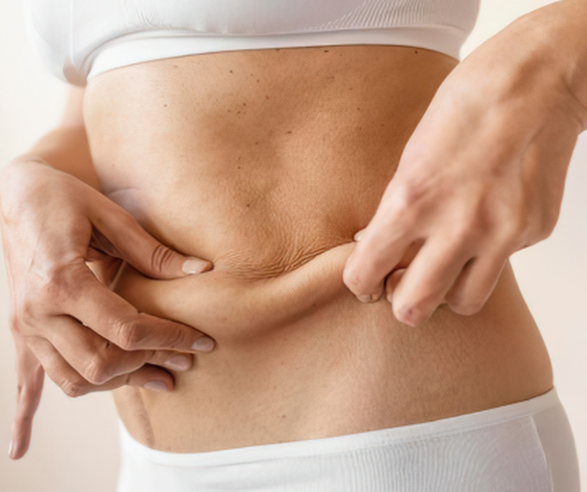 Will Insurance Cover Loose Skin Removal in India?