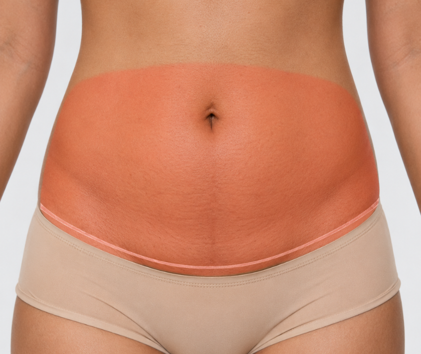 Stage 1 Foundation Package at Elegance Clinic Surat