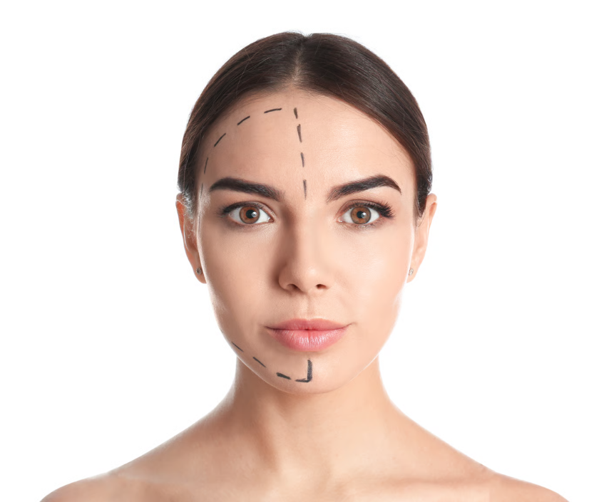 Facelift surgery to restore facial volume after weight loss