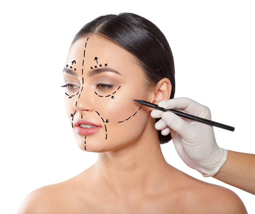 Fat graft to the face for natural volume restoration at Elegance Clinic